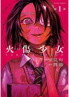 火伤少女